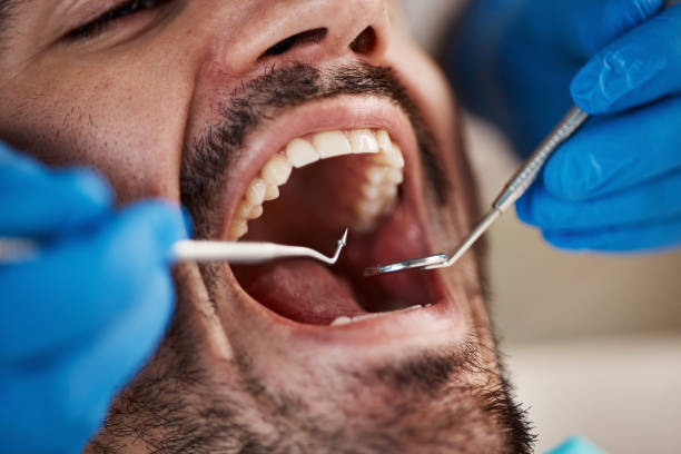 Best After-Hours Dental Trauma Care in Bell Nyon, CA
